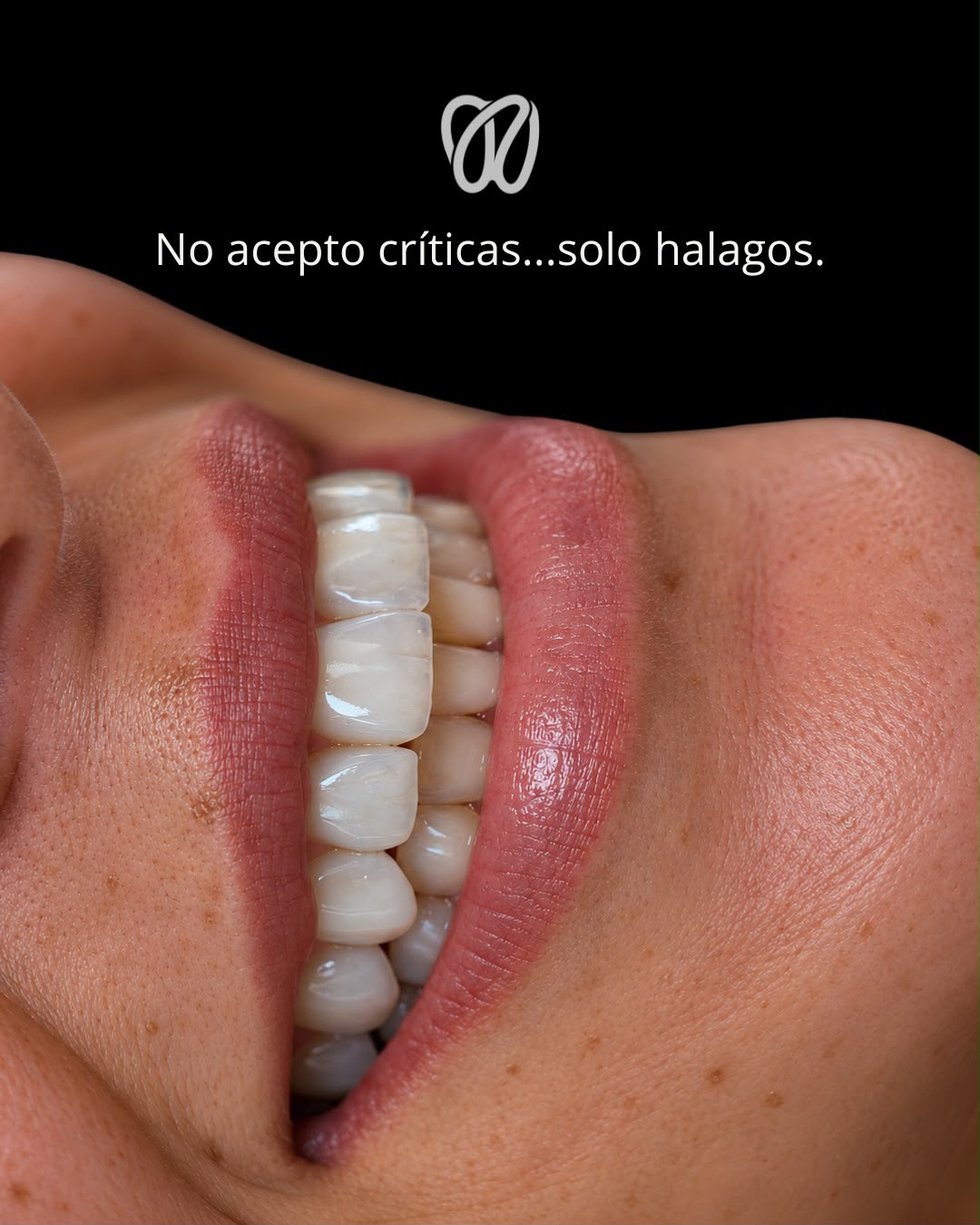 Sonrisa después del tratamiento